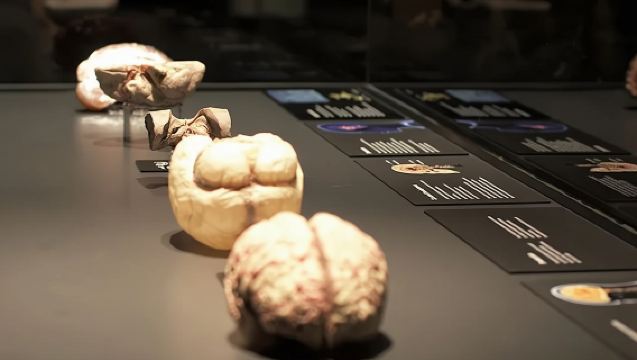 Venus Temple Sex Museum + Moco Museum + NEMO Science Museum + BODY WORLDS Amsterdam