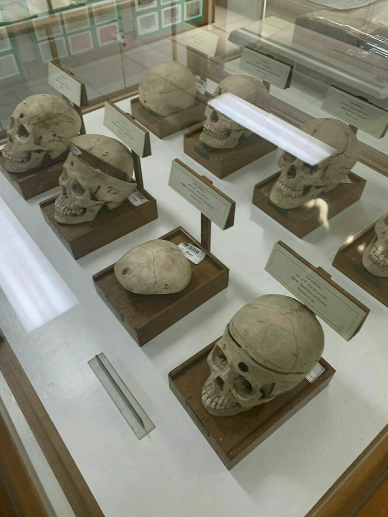 シリラート 死体 博物館