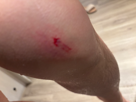 卡塔坦尼海岸泳池別墅- 僅限成人（SHA Extra Plus）優惠