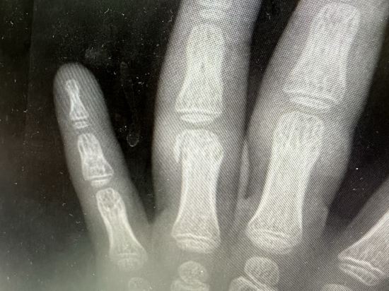 達拉海角渡假村優惠