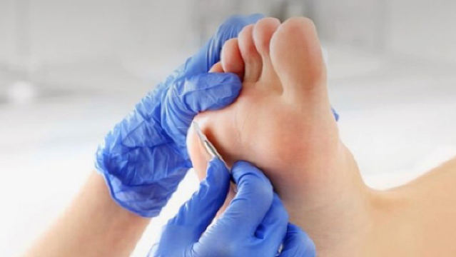 Besas Medicinska fotvård