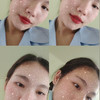 mild_phkm