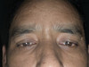 Rakeshnegi