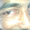 bnnm MD tarikon