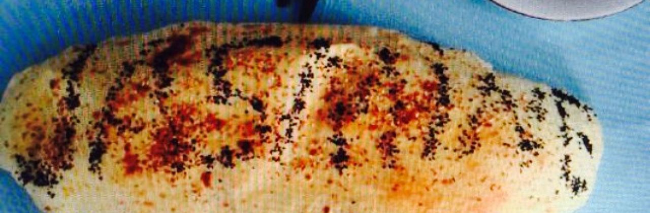 The Mulberry Tree Cafe-Restaurant