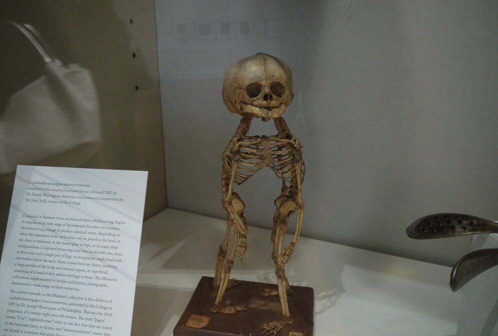 Mutter Museum Attractions Philadelphia County Travel Review Travel Guide Trip Com