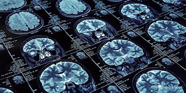 10th Annual BIDMC Neuroscience Nursing Symposium | BIDMC Klarman Building - Linde Family Conference Center