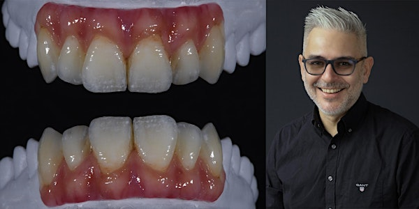 Digitally Handcrafted Zr Bridge: Complete Workflow From Design to Glaze | Skillbond Direct Ltd
