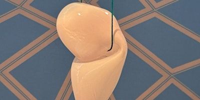 Lunchtime Talk: At the Centre of it All with Artist Simon Le Ruez | Graves Gallery