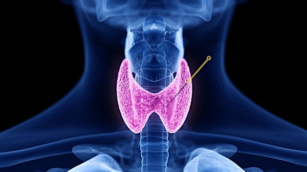 CEU - Acupuncture and Herbal Medicine Approaches to Thyroid Dysfunction | 2550 Shattuck Ave.