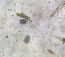 Fecal Egg Counting: Rowan County | N.C. Cooperative Extension, Rowan County Center