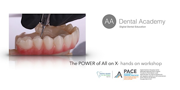 The Power of All On X | A A Dental Design Inc
