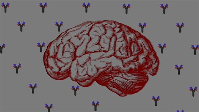 Saturday DNA! Biology Book Club Discussion: Brain on Fire | Cold Spring Harbor Laboratory | DNA Learning Center