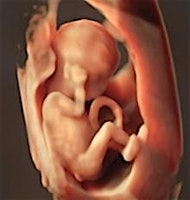 Fetal Ultrasound: From first trimester to advanced fetal anomalies | Texas Children's Pavilion for Women