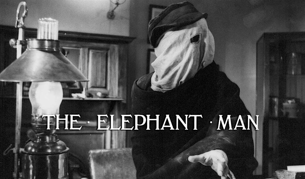 The Elephant Man 45th Anniversary | The Emmaus Theatre