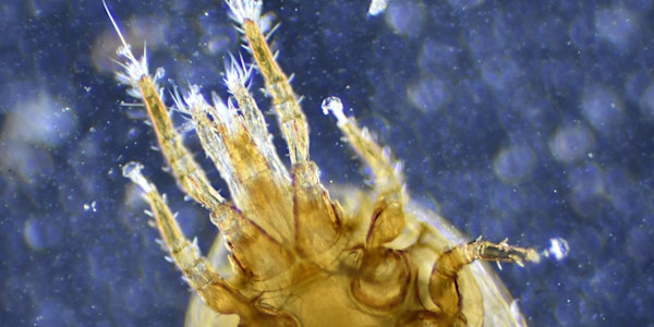 FREE Under the Microscope: Living Soils | Compost Education Centre