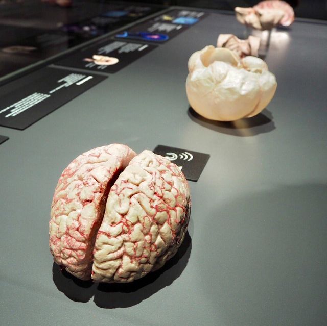 Body Worlds - Amsterdam, Netherlands