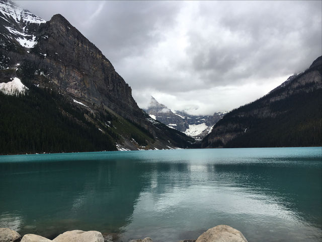 Unforgettable 🇨🇦Lake Louise