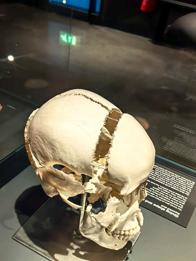 醫科生必去的人體奧妙展@Amsterdam 