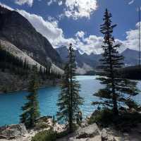 Moraine Lake 🏞️🌲