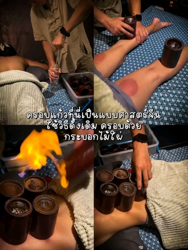 แชร์ประสบการณ์ครอบแก้วครั้งแรก เจ็บมั้ย? มาดูกัน