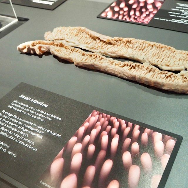 Body Worlds - Amsterdam, Netherlands