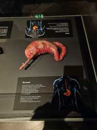Exploring the Human Body at Body Worlds Amsterdam
