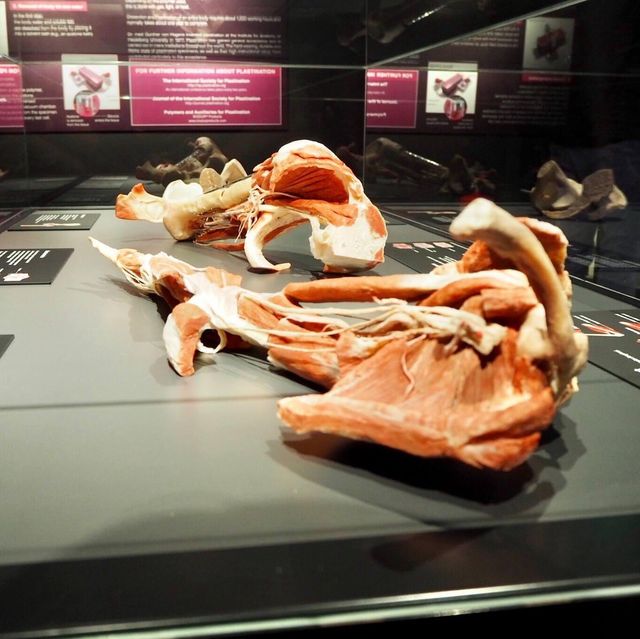Body Worlds - Amsterdam, Netherlands