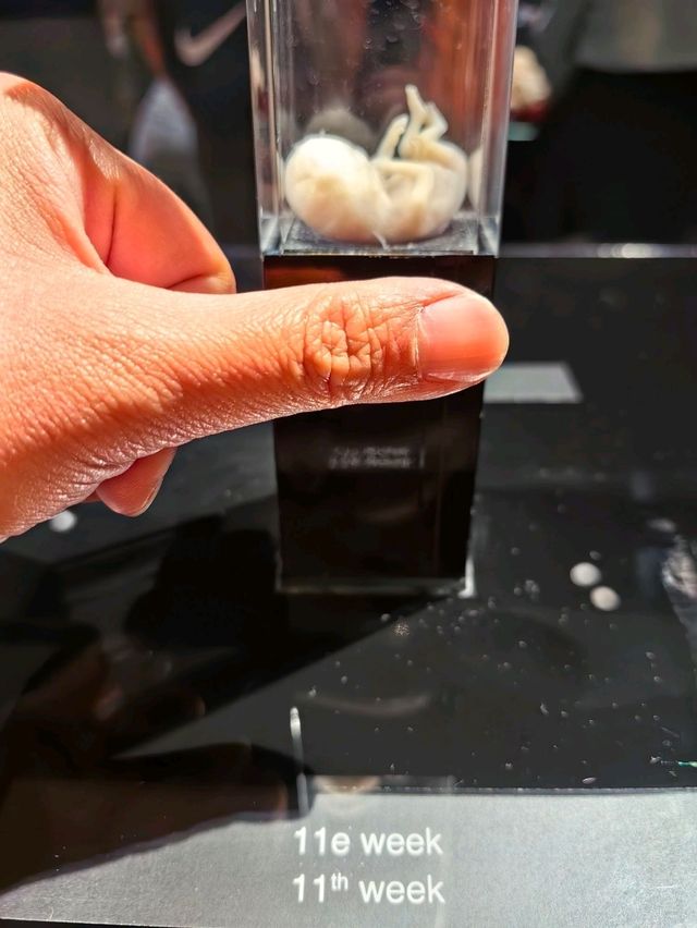 醫科生必去的人體奧妙展@Amsterdam 