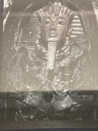 Egypt’s Greasyest Flex: A Sickly Boy’s $650Millions Goodbye