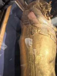 Egypt’s Greasyest Flex: A Sickly Boy’s $650Millions Goodbye