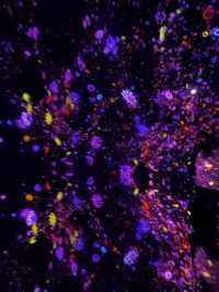 เที่ยวผจญภัยใน TeamLab @โตเกียว