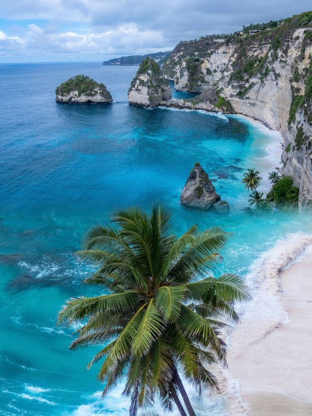！！去咗一趟峇里島，呢個後頸都太大啦