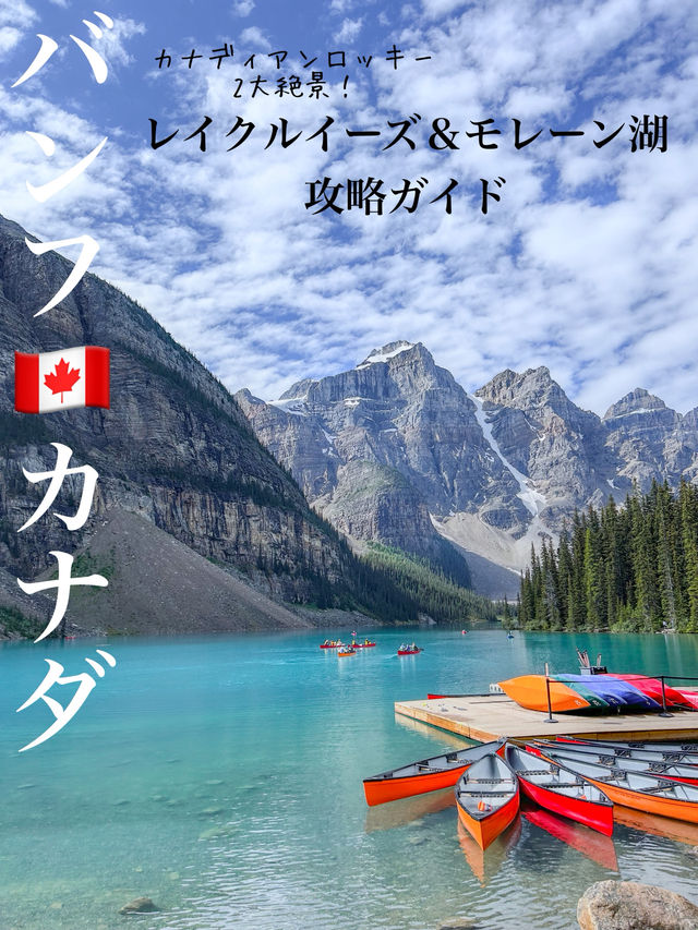 🏔️✨レイクルイーズ＆モレーン湖 攻略ガイド🇨🇦✨