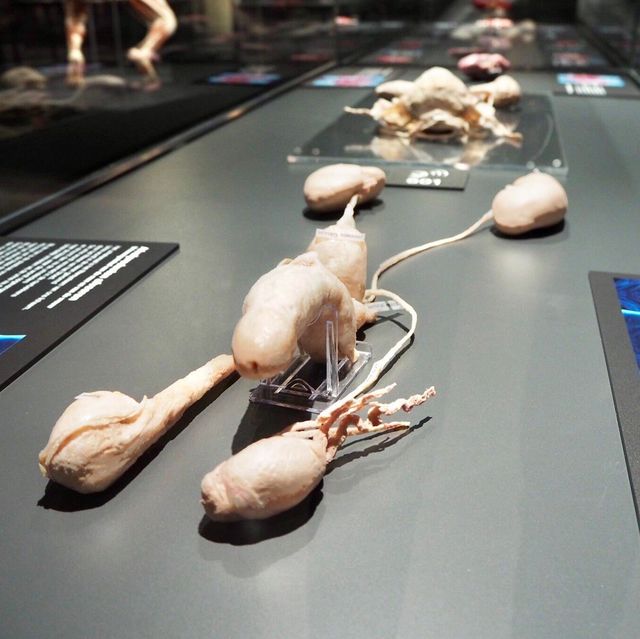 Body Worlds - Amsterdam, Netherlands