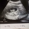 顏阿旭