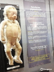 Moulagenmuseum - Museum of wax moulages